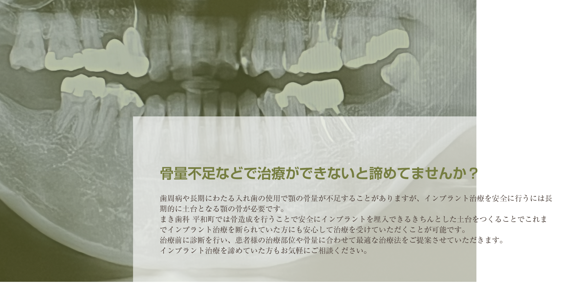 骨量不足などで治療ができないと諦めてませんか？
