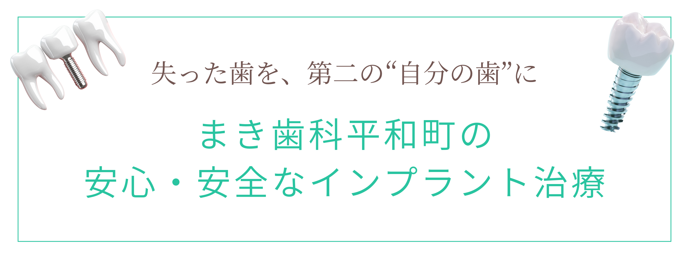 失った歯を、第二の自分の歯に
まき歯科平和町の安心・安全なインプラント治療